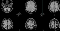 Your Intelligence Might Be Determined by a Rhythm in Your Brain