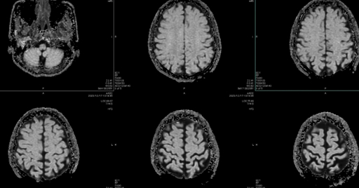 Your Intelligence Might Be Determined by a Rhythm in Your Brain