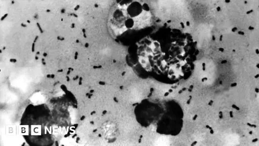 Arizona resident dies from pneumonic plague, health officials say