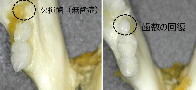 Clinical trial set to begin in Japan for medicine to help grow teeth