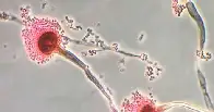 Fungal infections are getting harder to treat